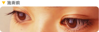 施術前